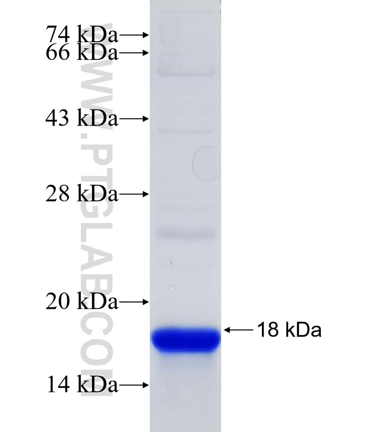 WEE1 fusion protein Ag30194 SDS-PAGE