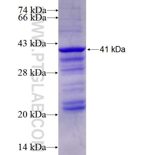 WEE1 fusion protein Ag5874 SDS-PAGE