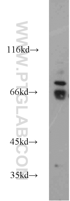 Western Blot (WB) analysis of human ovary tissue using WEE2 Polyclonal antibody (55119-1-AP)