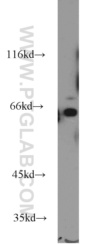 Western Blot (WB) analysis of Jurkat cells using WEE2 Polyclonal antibody (55119-1-AP)