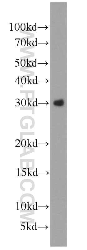 Western Blot (WB) analysis of HEK-293 cells using WFDC1 Polyclonal antibody (13204-1-AP)