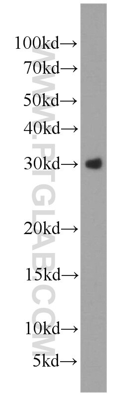 Western Blot (WB) analysis of HEK-293 cells using WFDC1 Polyclonal antibody (13204-1-AP)