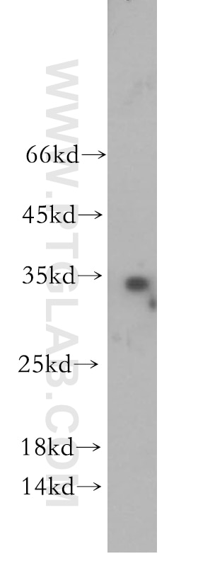 Western Blot (WB) analysis of PC-3 cells using WFDC1 Polyclonal antibody (13204-1-AP)