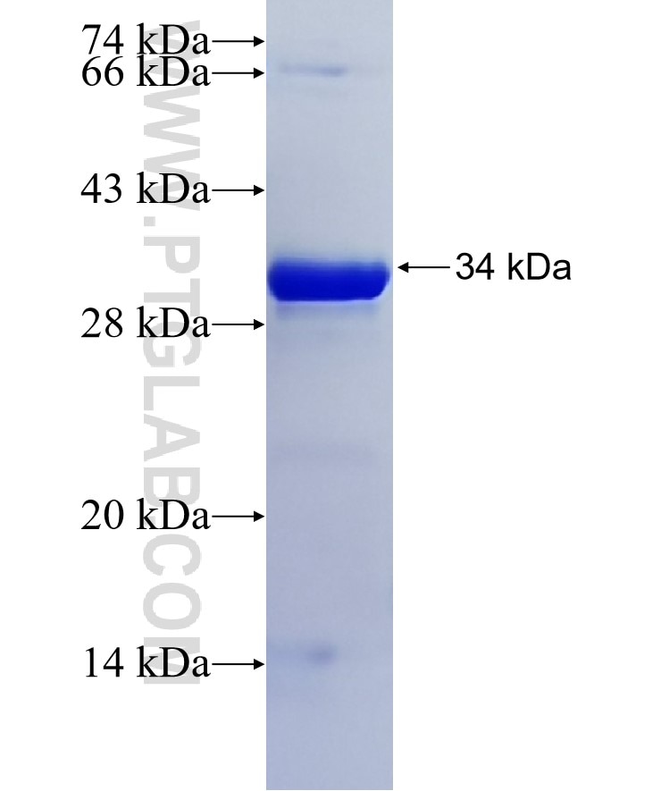 WFDC12 fusion protein Ag18795 SDS-PAGE