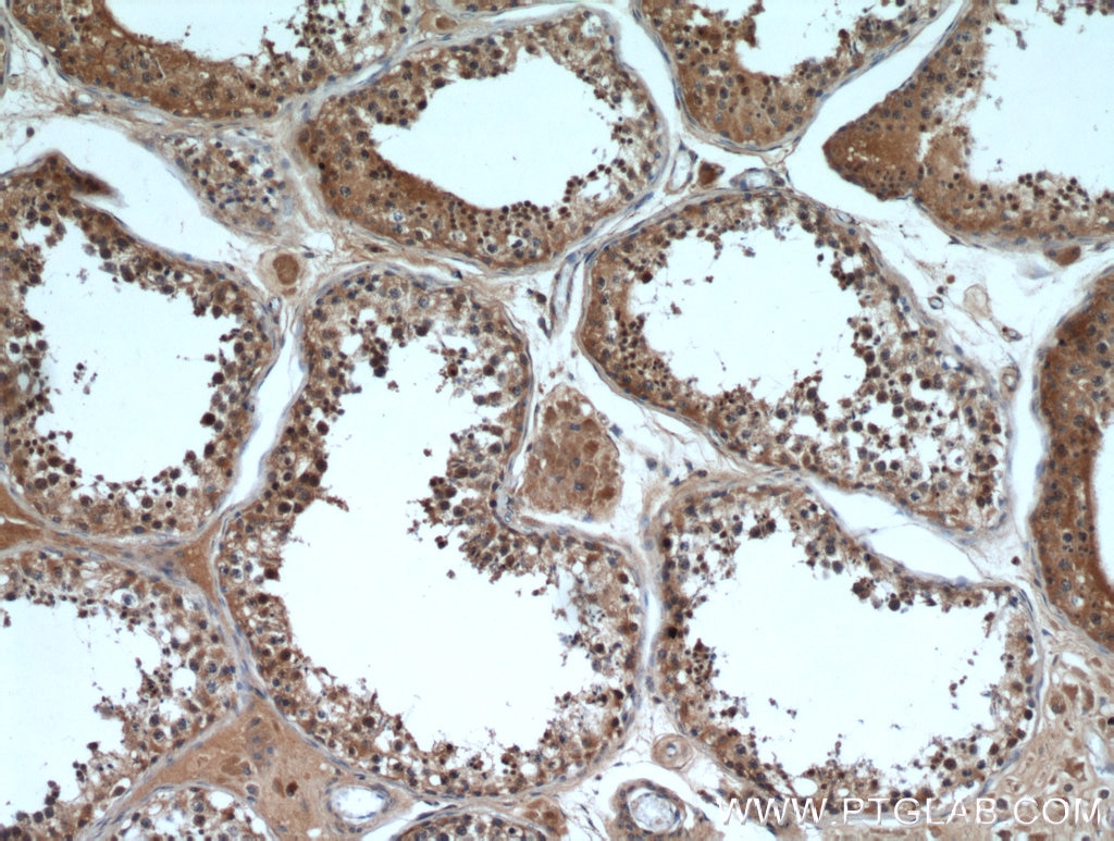 Immunohistochemistry (IHC) staining of human testis tissue using HE4 Polyclonal antibody (14406-1-AP)