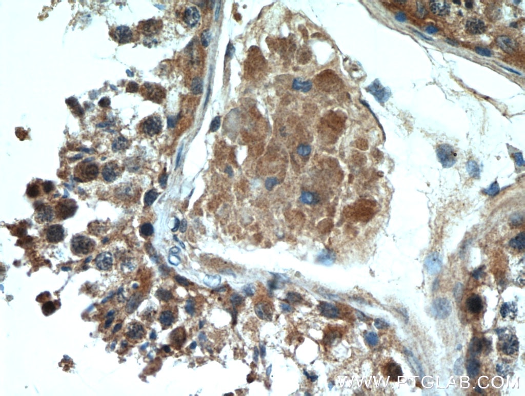 IHC staining of human testis using 14406-1-AP