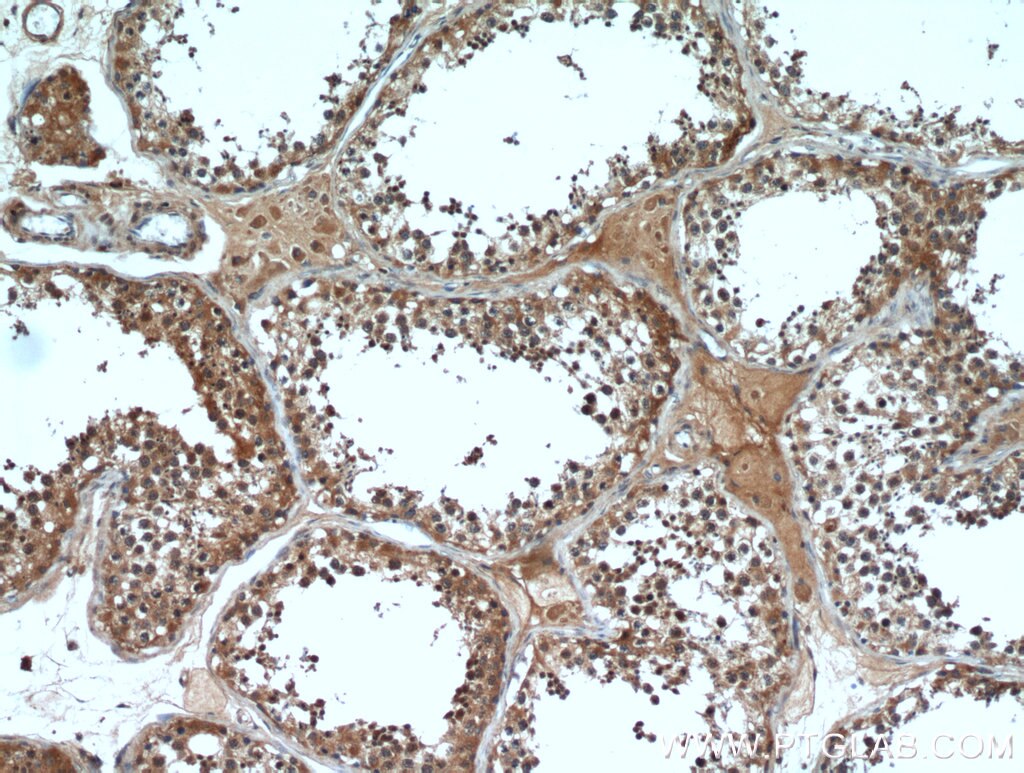 Immunohistochemistry (IHC) staining of human testis tissue using HE4 Polyclonal antibody (14406-1-AP)