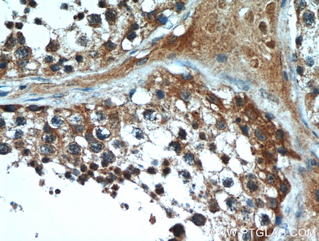 Immunohistochemistry (IHC) staining of human testis tissue using HE4 Polyclonal antibody (14406-1-AP)