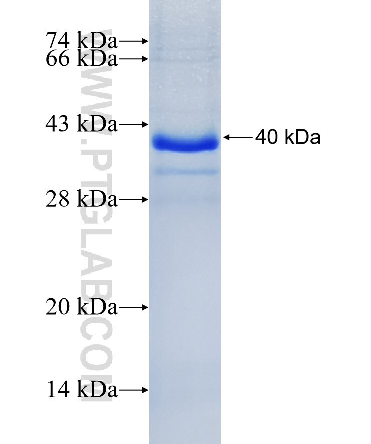 HE4 fusion protein Ag5684 SDS-PAGE