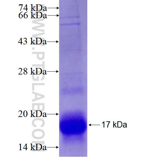 HE4 fusion protein Ag5936 SDS-PAGE