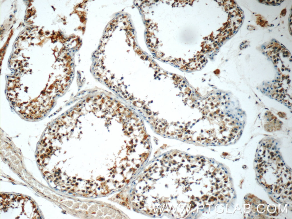 Immunohistochemistry (IHC) staining of human testis tissue using WFDC3 Polyclonal antibody (24917-1-AP)