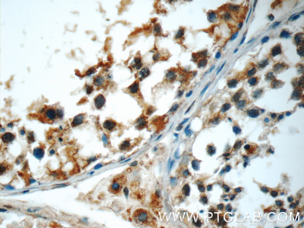 Immunohistochemistry (IHC) staining of human testis tissue using WFDC3 Polyclonal antibody (24917-1-AP)