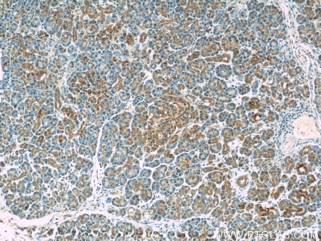 Immunohistochemistry (IHC) staining of human pancreas tissue using WFDC3 Polyclonal antibody (24917-1-AP)