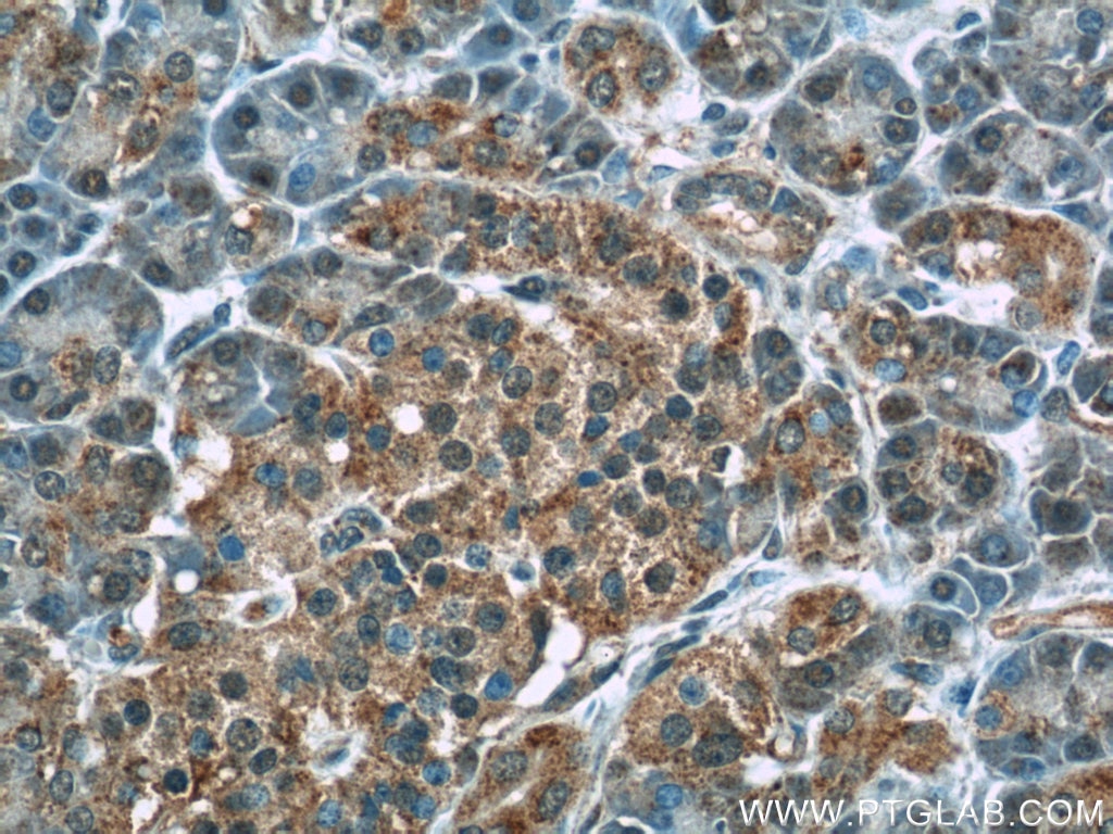 Immunohistochemistry (IHC) staining of human pancreas tissue using WFDC3 Polyclonal antibody (24917-1-AP)