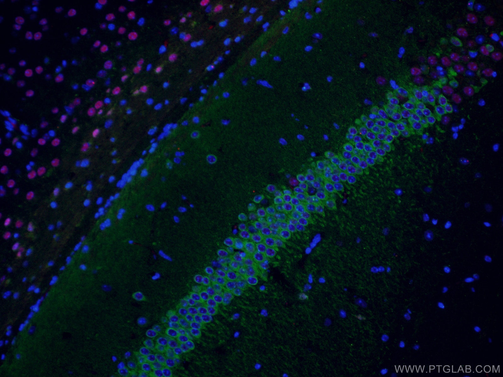 Immunofluorescence (IF) / fluorescent staining of mouse brain tissue using WFS1 Polyclonal antibody (11558-1-AP)