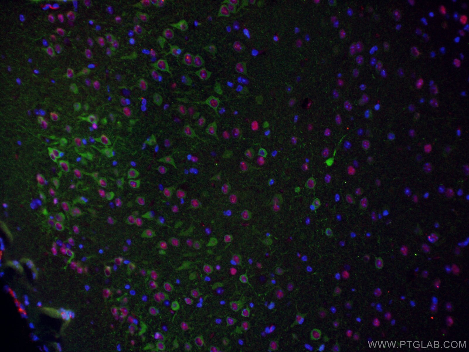 Immunofluorescence (IF) / fluorescent staining of mouse brain tissue using WFS1 Polyclonal antibody (11558-1-AP)