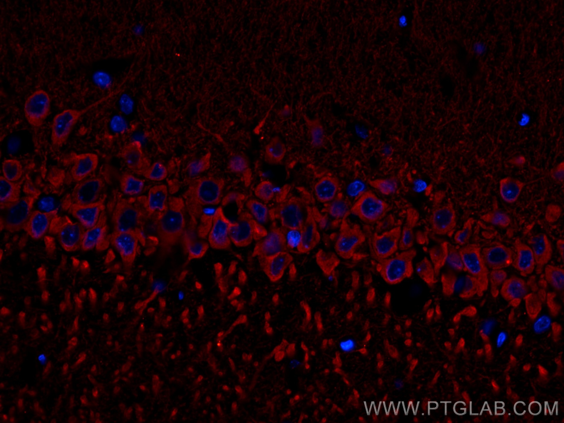 Immunofluorescence (IF) / fluorescent staining of rat brain tissue using WFS1 Polyclonal antibody (11558-1-AP)