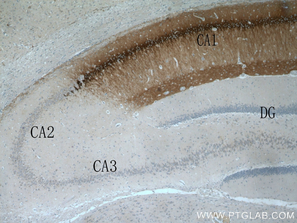 Immunohistochemistry (IHC) staining of rat brain tissue using WFS1 Polyclonal antibody (11558-1-AP)