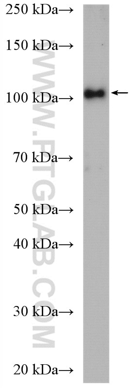 Western Blot (WB) analysis of HEK-293 cells using WFS1 Polyclonal antibody (11558-1-AP)