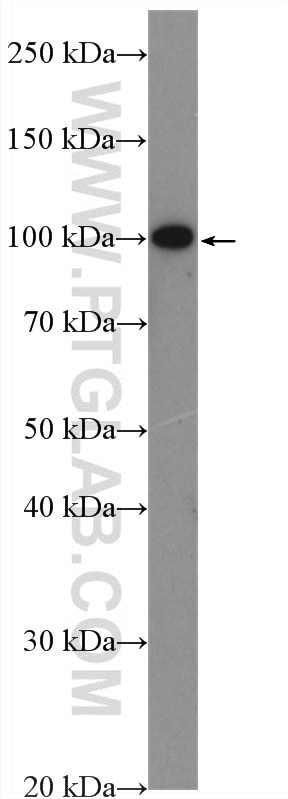 Western Blot (WB) analysis of SH-SY5Y cells using WFS1 Polyclonal antibody (11558-1-AP)