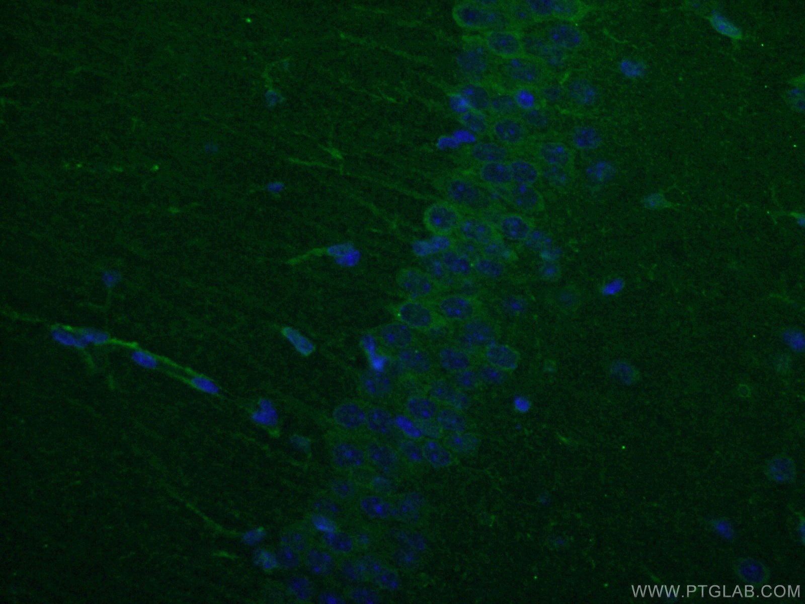 IF Staining of mouse brain using 26995-1-AP