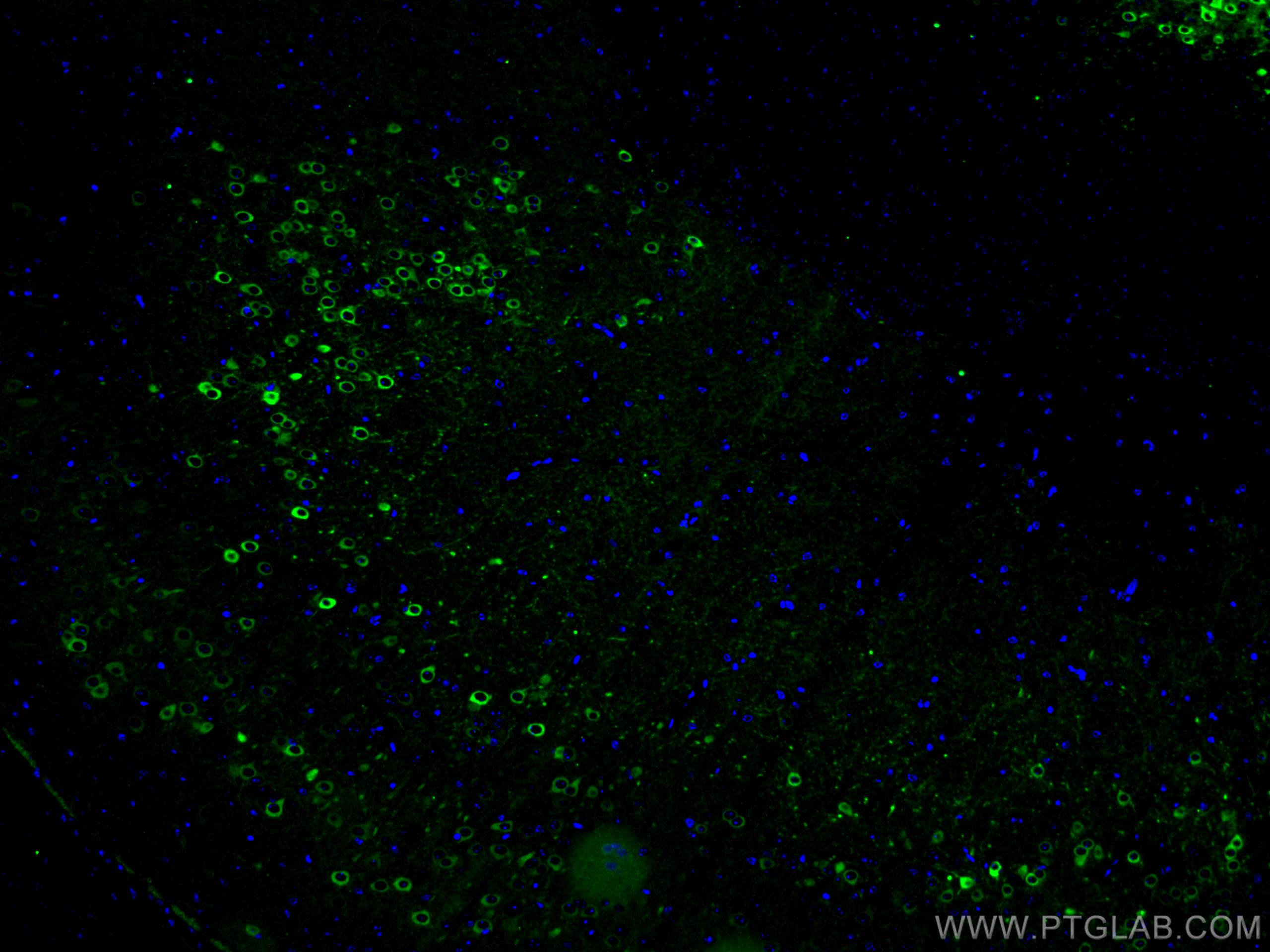 IF Staining of mouse brain using 26995-1-AP