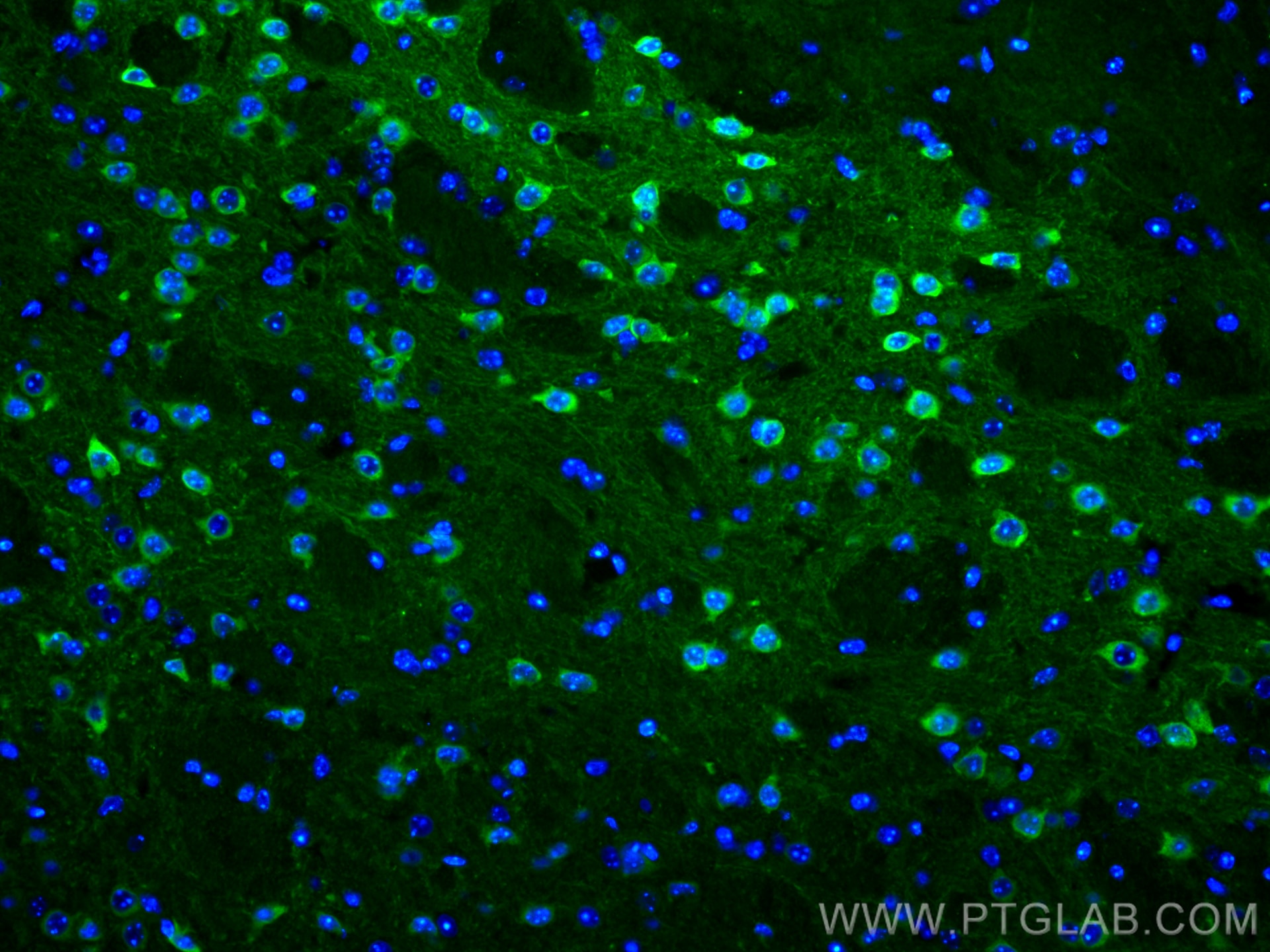 Immunofluorescence (IF) / fluorescent staining of mouse brain tissue using WFS1 Polyclonal antibody (26995-1-AP)