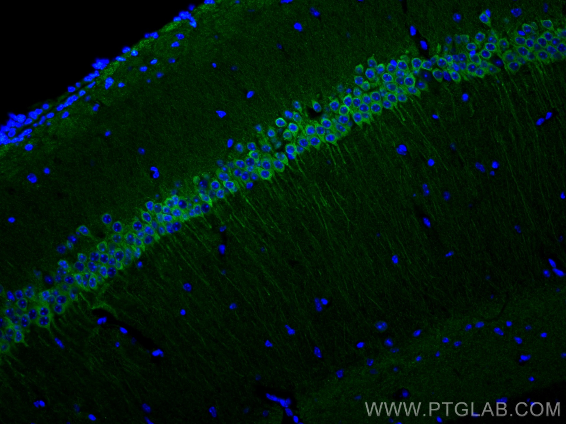 Immunofluorescence (IF) / fluorescent staining of mouse brain tissue using WFS1 Polyclonal antibody (26995-1-AP)