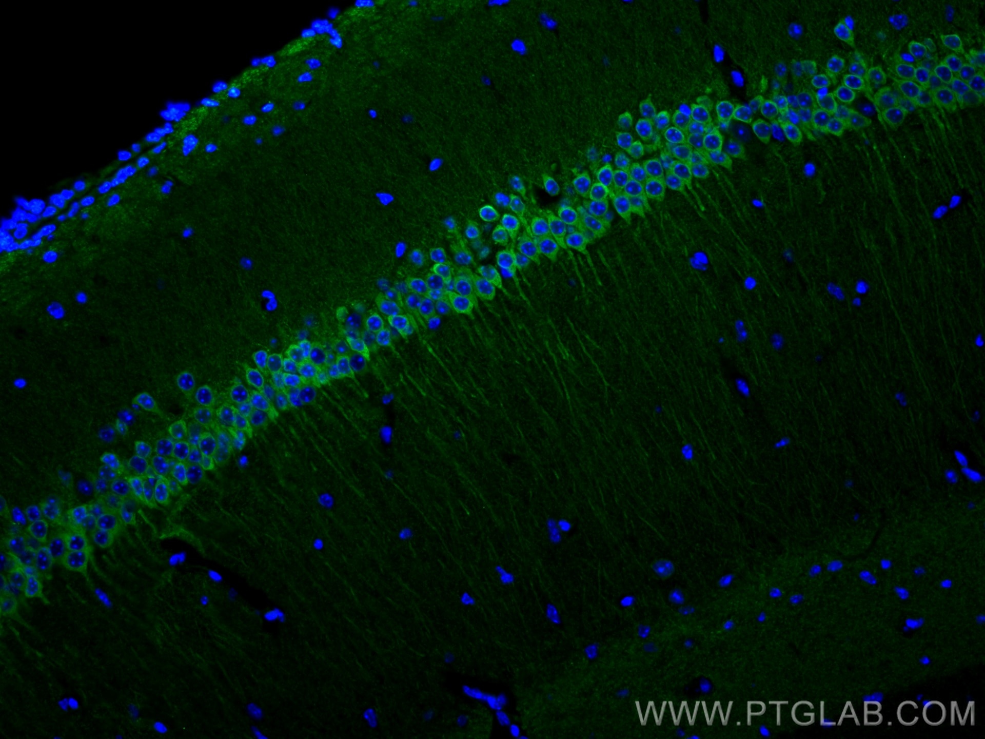 IF Staining of mouse brain using 26995-1-AP