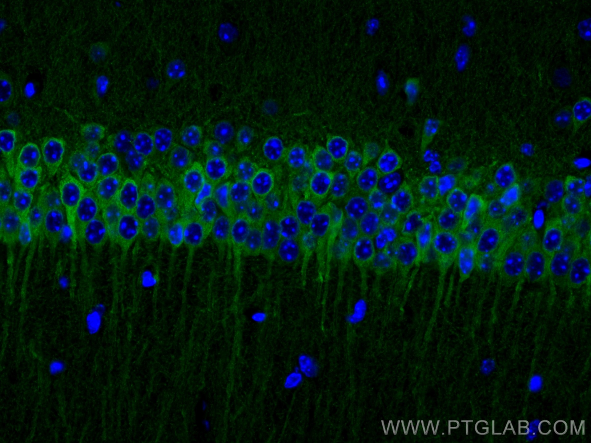 Immunofluorescence (IF) / fluorescent staining of mouse brain tissue using WFS1 Polyclonal antibody (26995-1-AP)