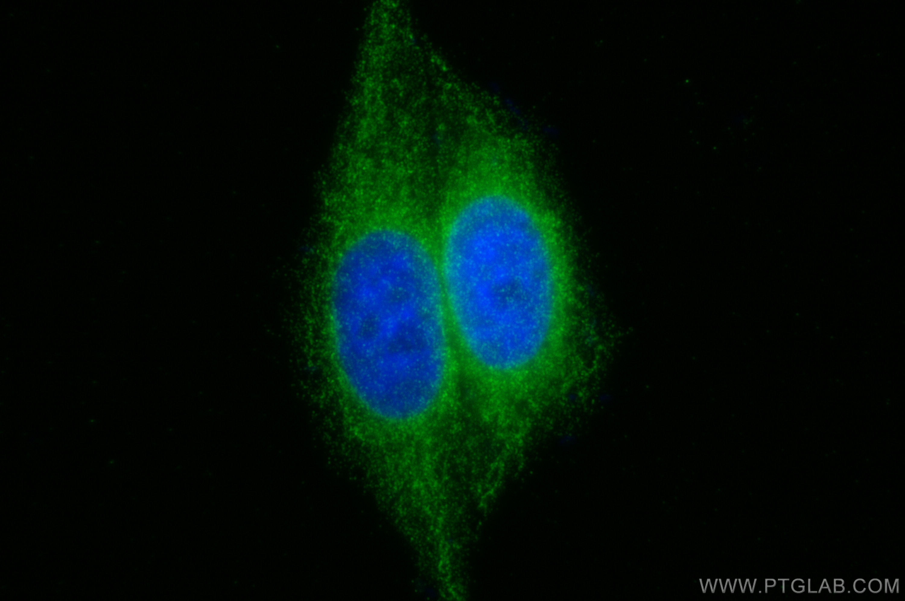 Immunofluorescence (IF) / fluorescent staining of HepG2 cells using WFS1 Polyclonal antibody (26995-1-AP)