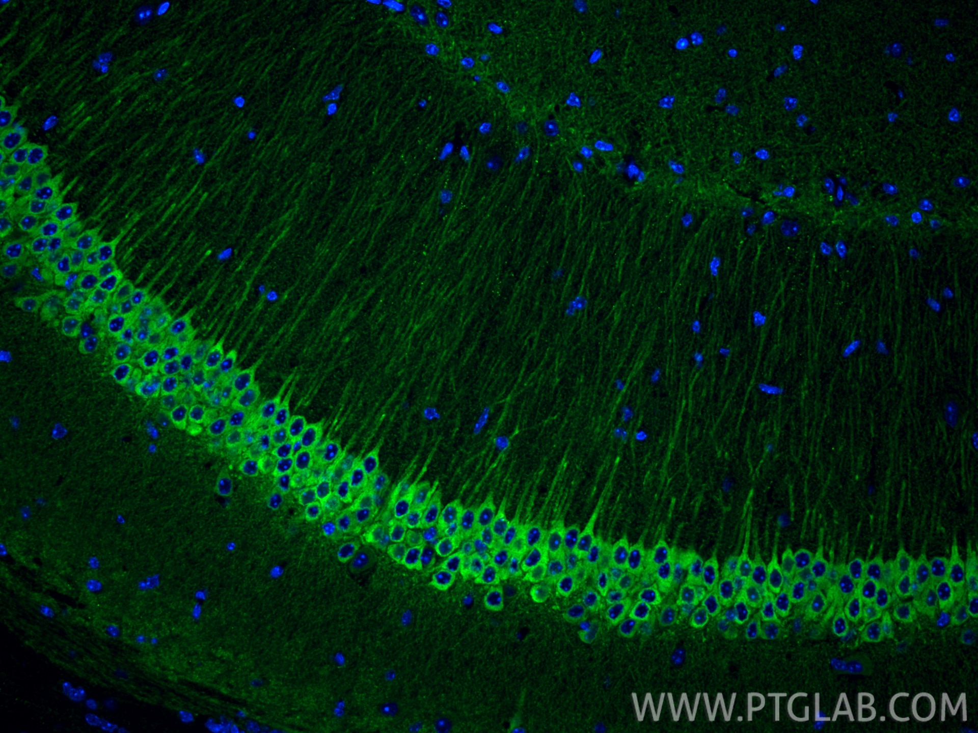 Immunofluorescence (IF) / fluorescent staining of mouse brain tissue using WFS1 Polyclonal antibody (26995-1-AP)