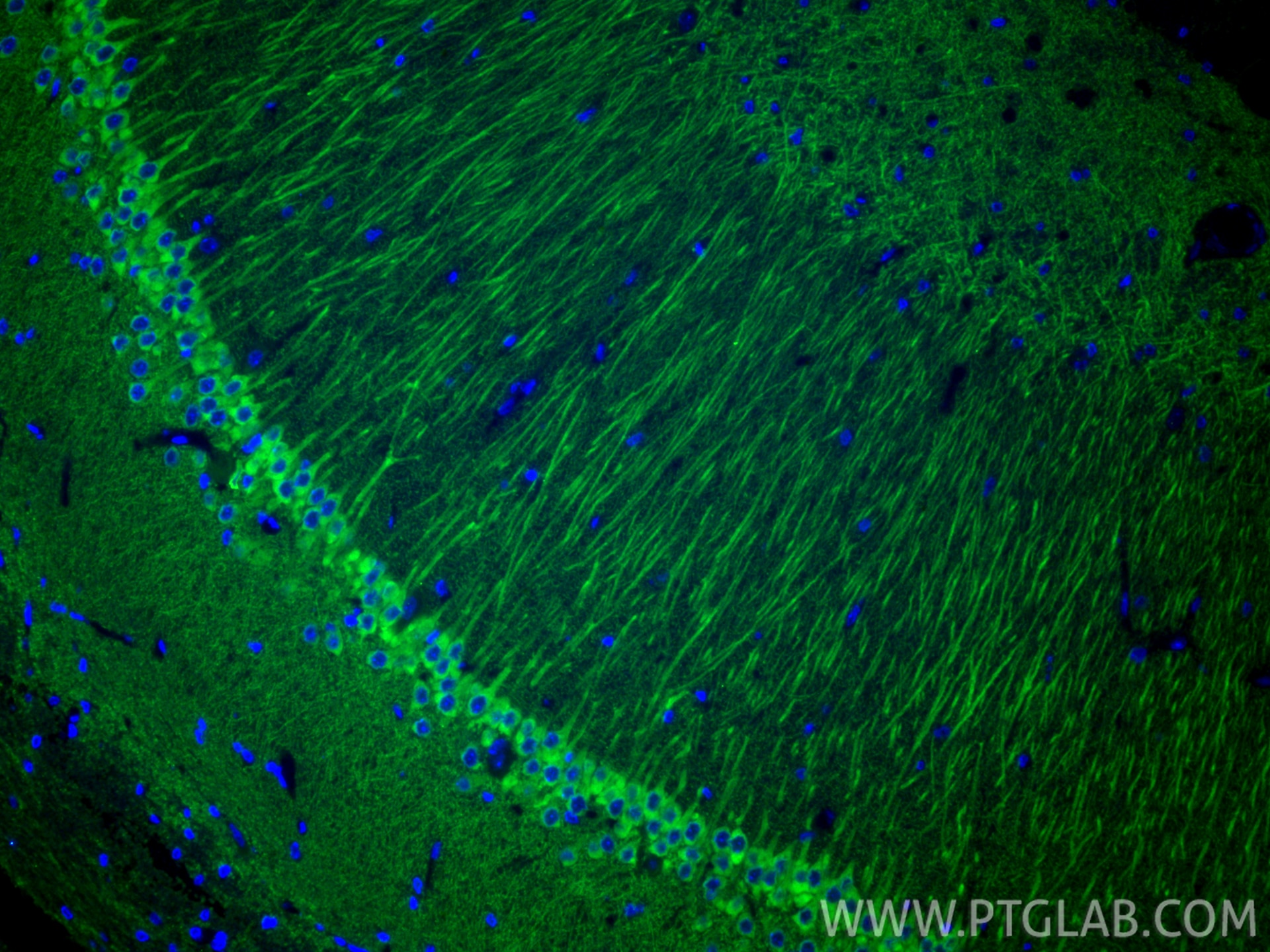 Immunofluorescence (IF) / fluorescent staining of rat brain tissue using WFS1 Polyclonal antibody (26995-1-AP)