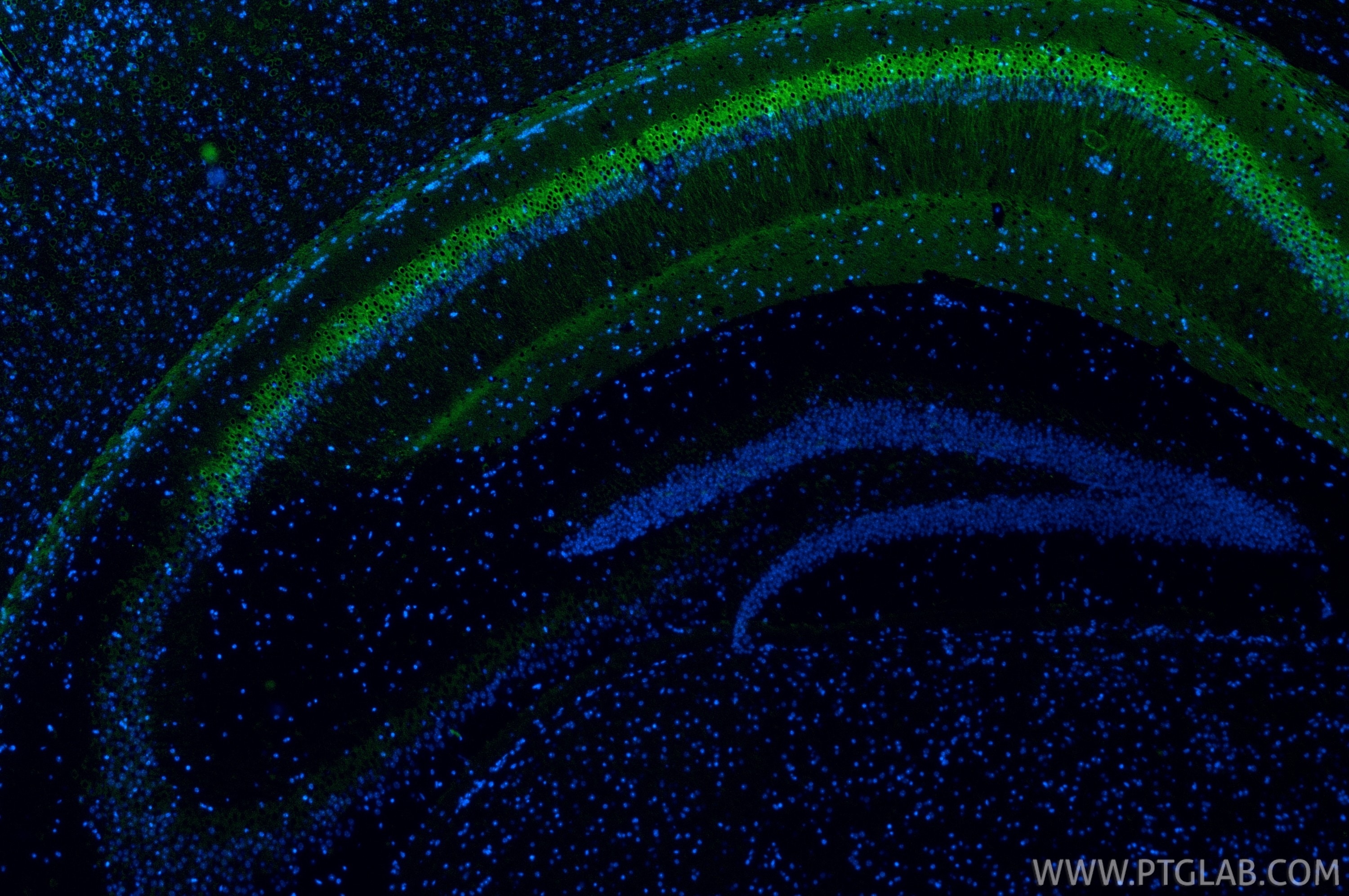 Immunofluorescence (IF) / fluorescent staining of rat brain tissue using WFS1 Polyclonal antibody (26995-1-AP)