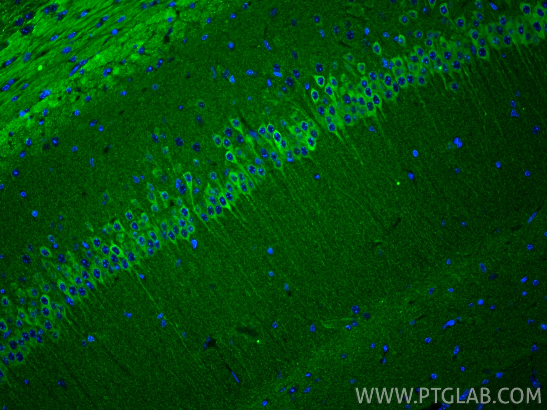 Immunofluorescent analysis of (4% PFA) fixed paraffin-embedded mouse brain tissue using WFS1 antibody (26995-1-AP) at dilution of 1:200 and CoraLite®488-Conjugated Goat Anti-Rabbit IgG(H+L) (SA00013-2). Heat mediated antigen retrieval with Tris-EDTA buffer (pH 9.0). Immunofluorescence (IF) / fluorescent staining of mouse brain tissue using WFS1 Polyclonal antibody (26995-1-AP)