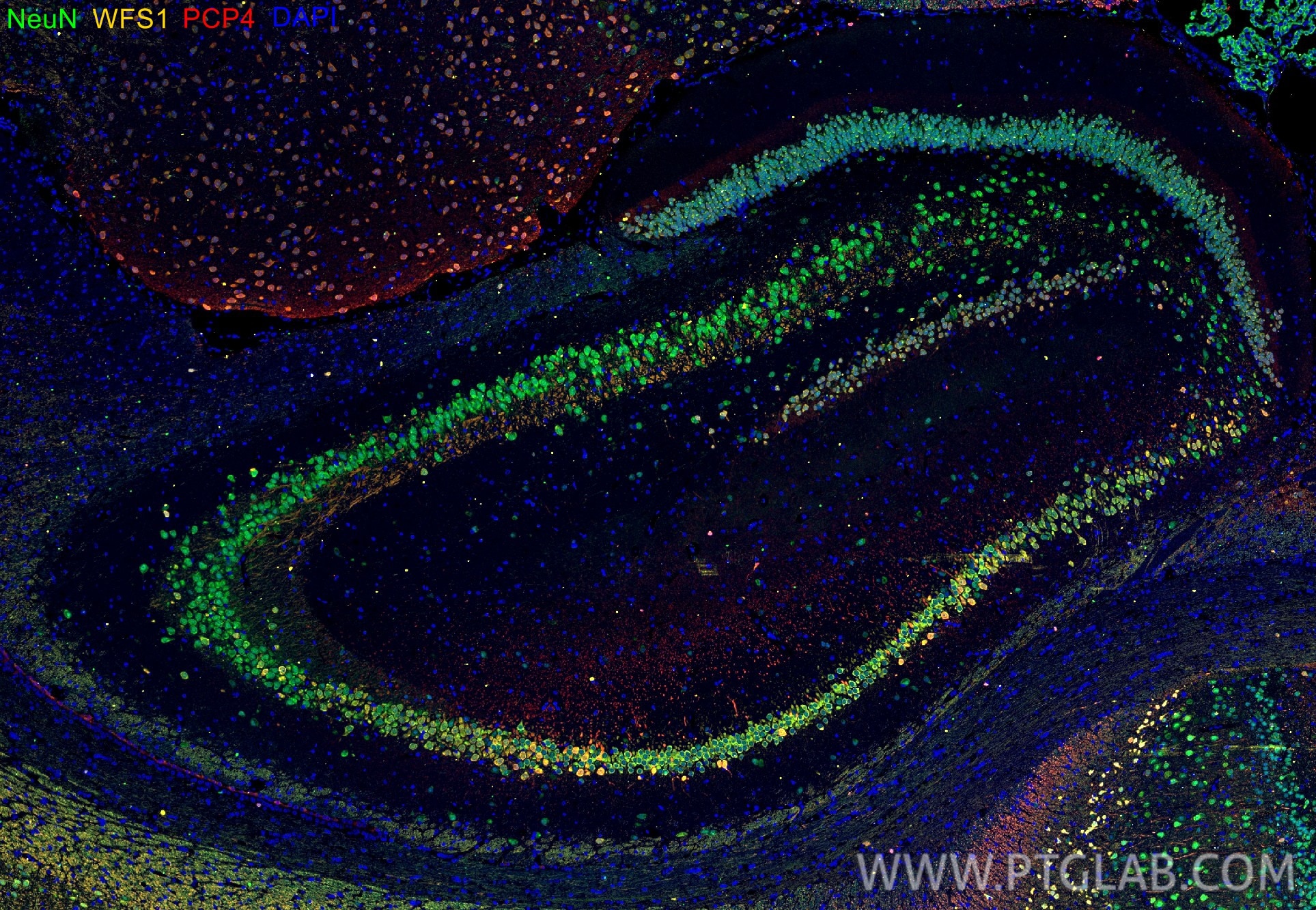 IF Staining of rat brain using 26995-1-AP Immunofluorescence (IF) / fluorescent staining of rat brain tissue using WFS1 Polyclonal antibody (26995-1-AP)