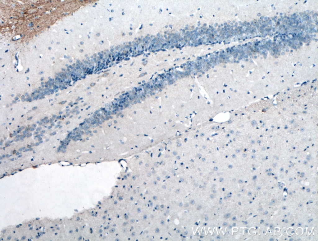 Immunohistochemistry (IHC) staining of mouse brain tissue using WFS1 Polyclonal antibody (26995-1-AP)