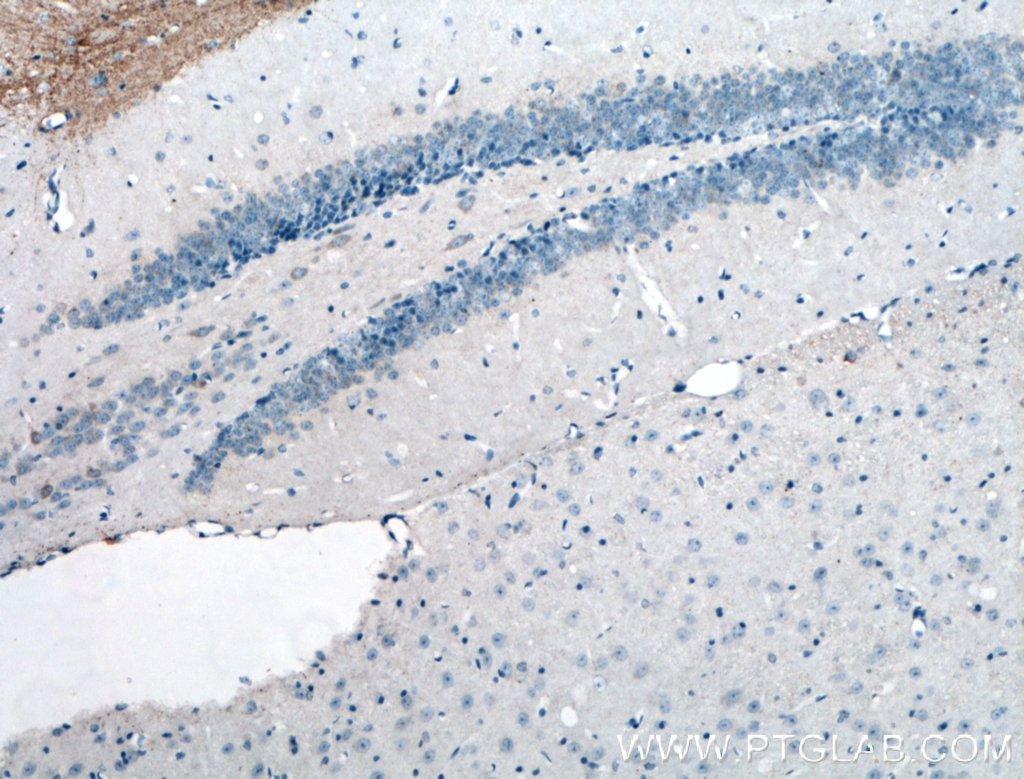 IHC staining of mouse brain using 26995-1-AP