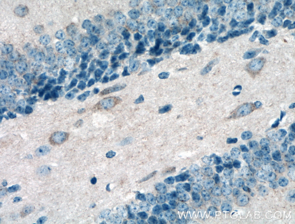 Immunohistochemistry (IHC) staining of mouse brain tissue using WFS1 Polyclonal antibody (26995-1-AP)