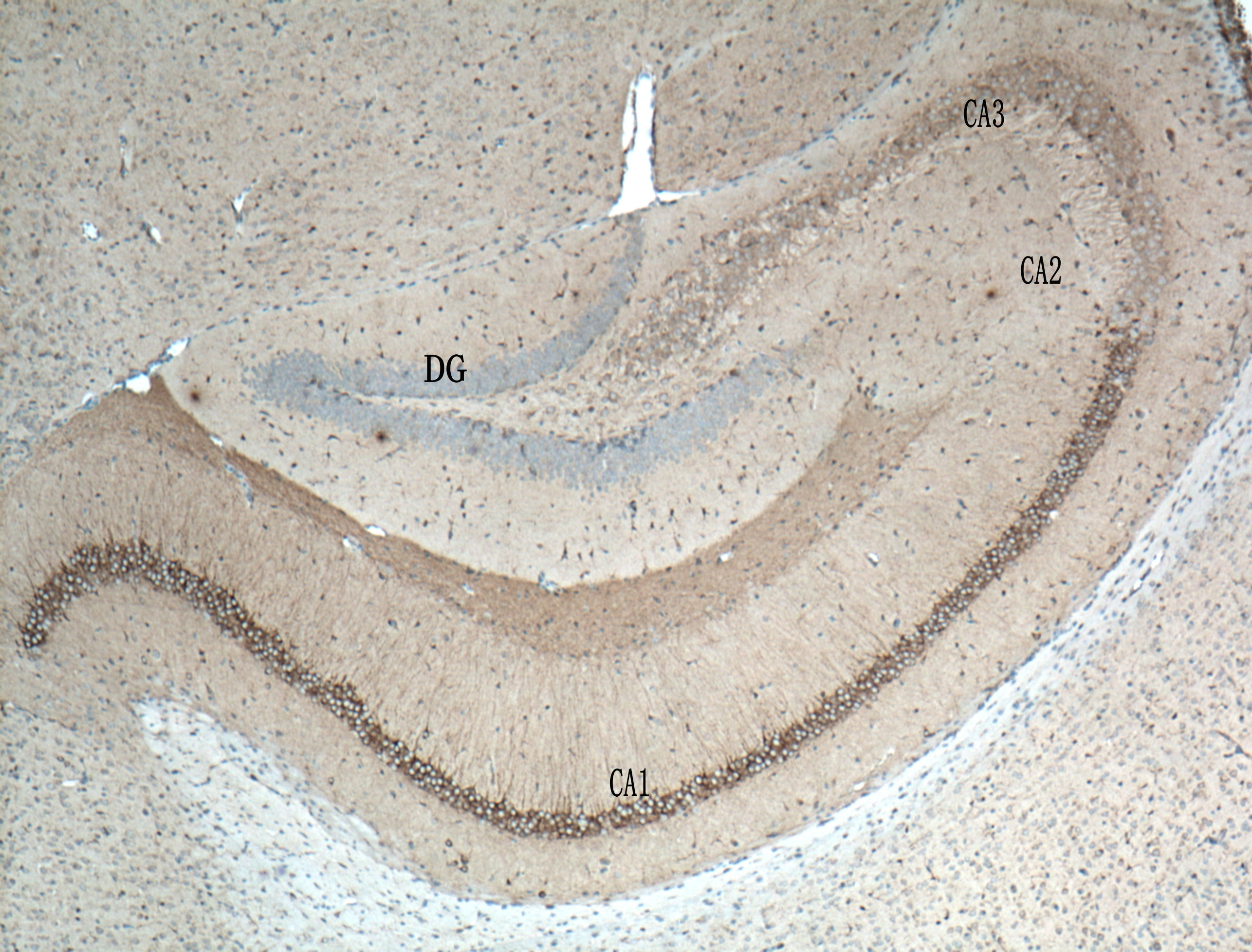 Immunohistochemistry (IHC) staining of mouse brain tissue using WFS1 Polyclonal antibody (26995-1-AP)