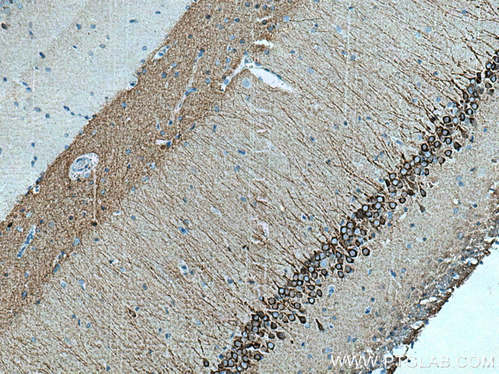 IHC staining of rat brain using 26995-1-AP