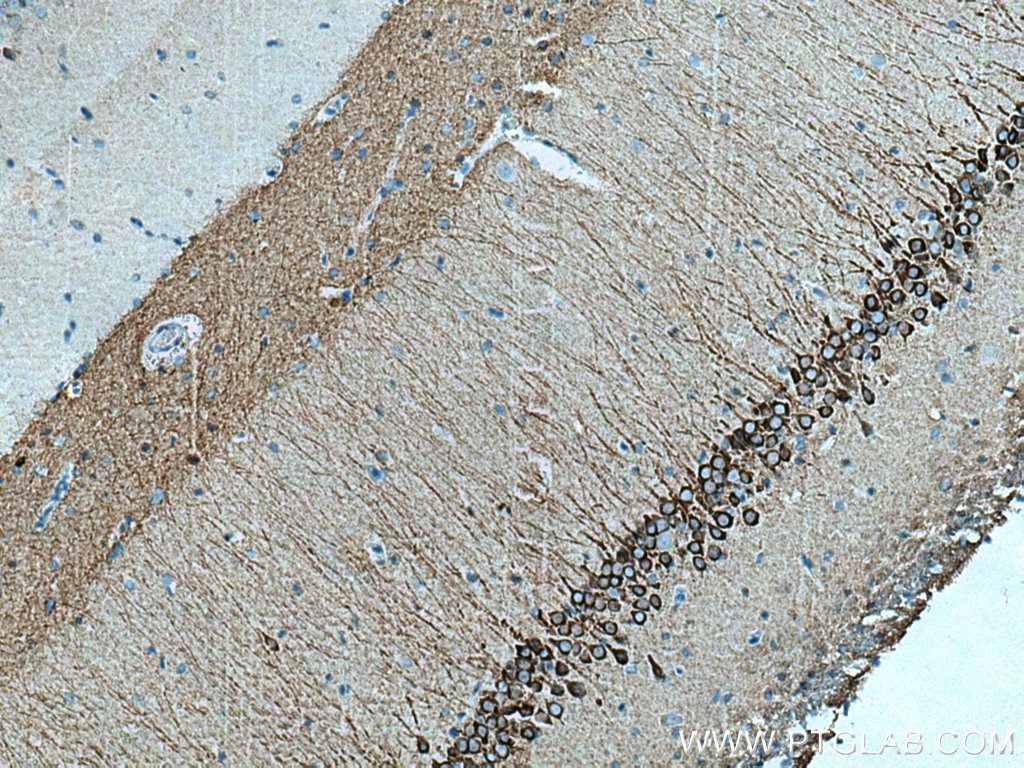 Immunohistochemistry (IHC) staining of rat brain tissue using WFS1 Polyclonal antibody (26995-1-AP)