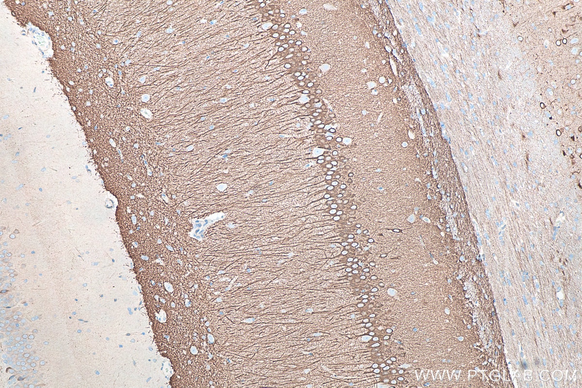 Immunohistochemistry (IHC) staining of rat brain tissue using WFS1 Polyclonal antibody (26995-1-AP)