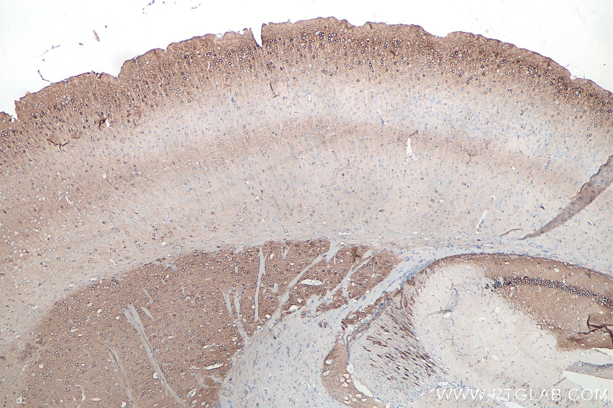 Immunohistochemistry (IHC) staining of mouse brain tissue using WFS1 Polyclonal antibody (26995-1-AP)