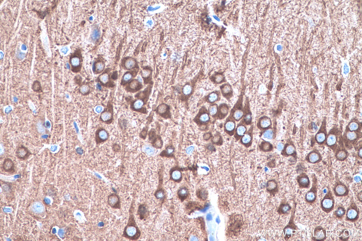 Immunohistochemistry (IHC) staining of rat brain tissue using WFS1 Polyclonal antibody (26995-1-AP)