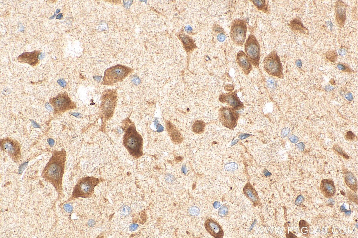 Immunohistochemistry (IHC) staining of rat brain tissue using WFS1 Polyclonal antibody (26995-1-AP)
