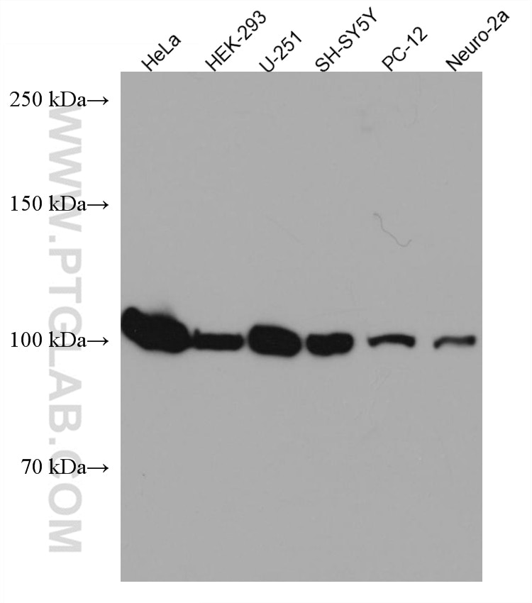 Western Blot (WB) analysis of various lysates using WFS1 Monoclonal antibody (67291-1-Ig)
