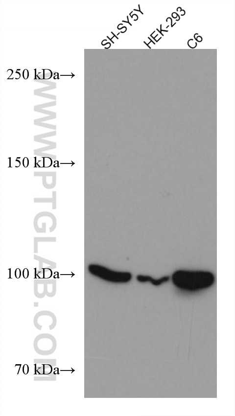 Western Blot (WB) analysis of various lysates using WFS1 Monoclonal antibody (67291-1-Ig)