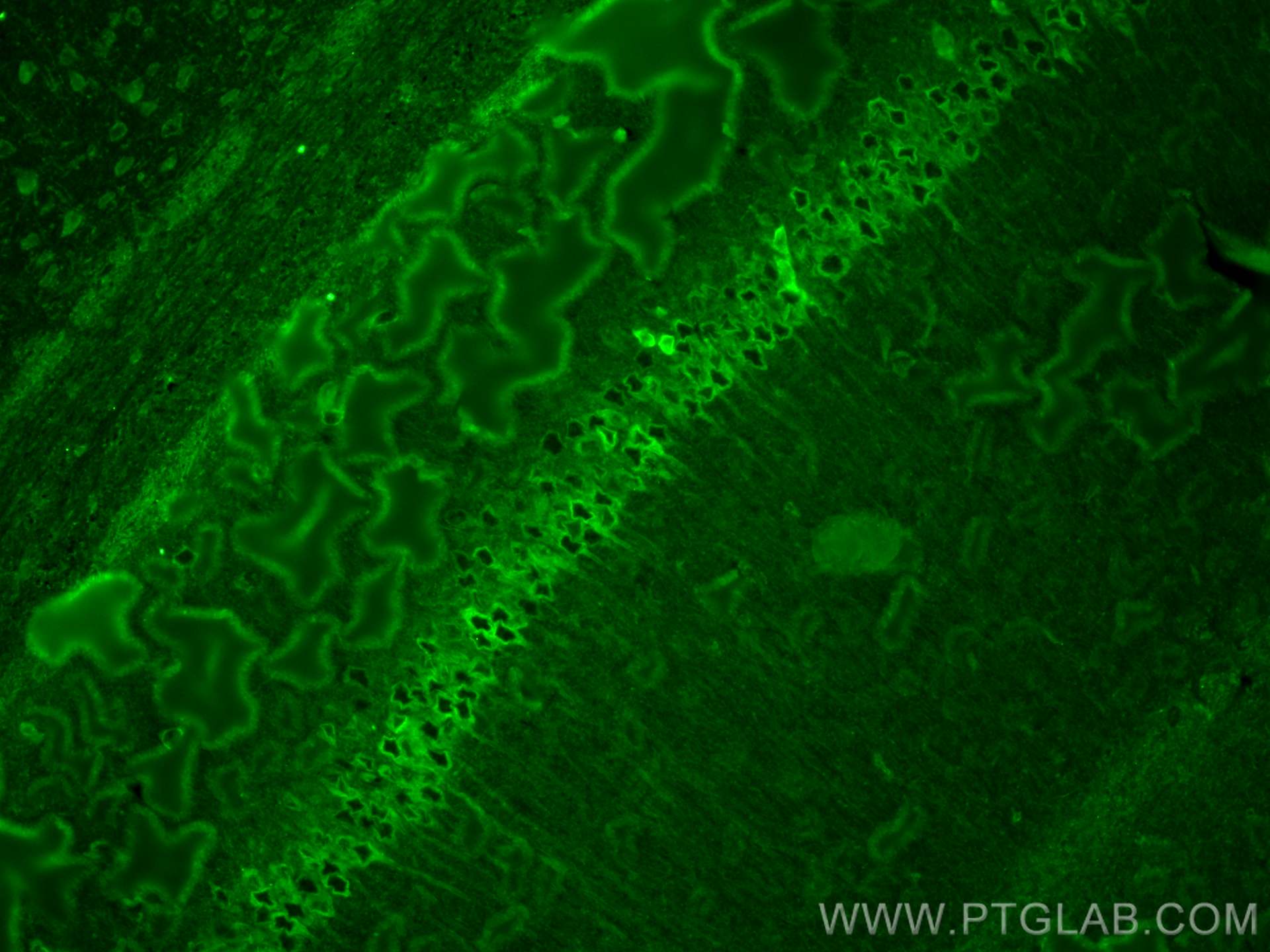 Immunofluorescence (IF) / fluorescent staining of mouse brain tissue using CoraLite® Plus 488-conjugated WFS1 Polyclonal anti (CL488-26995)