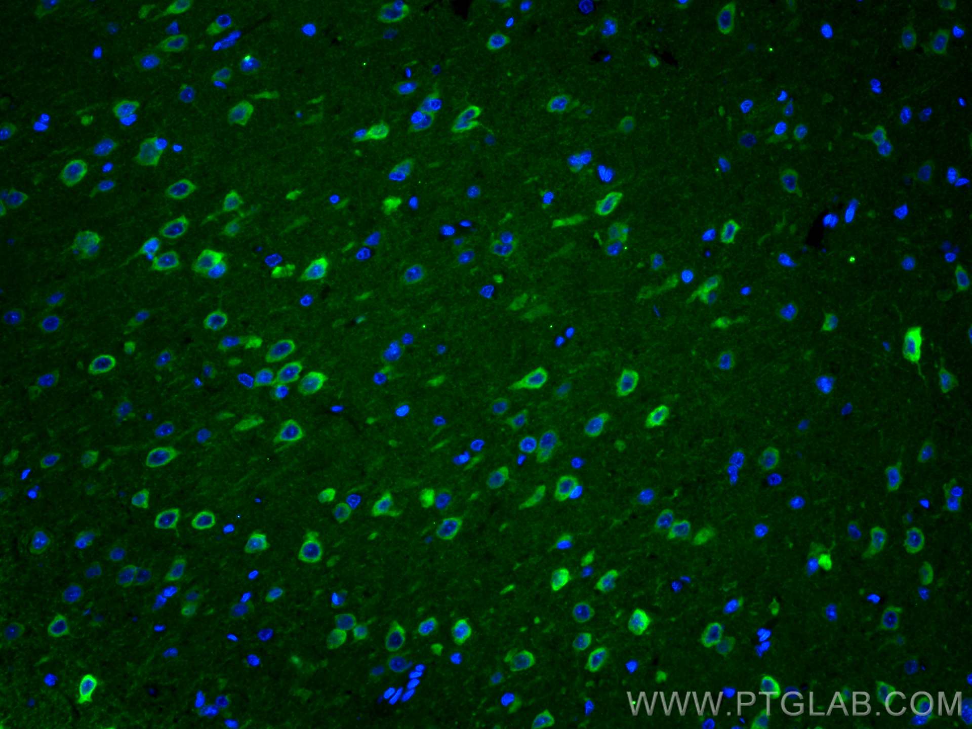 Immunofluorescence (IF) / fluorescent staining of rat brain tissue using CoraLite® Plus 488-conjugated WFS1 Polyclonal anti (CL488-26995)